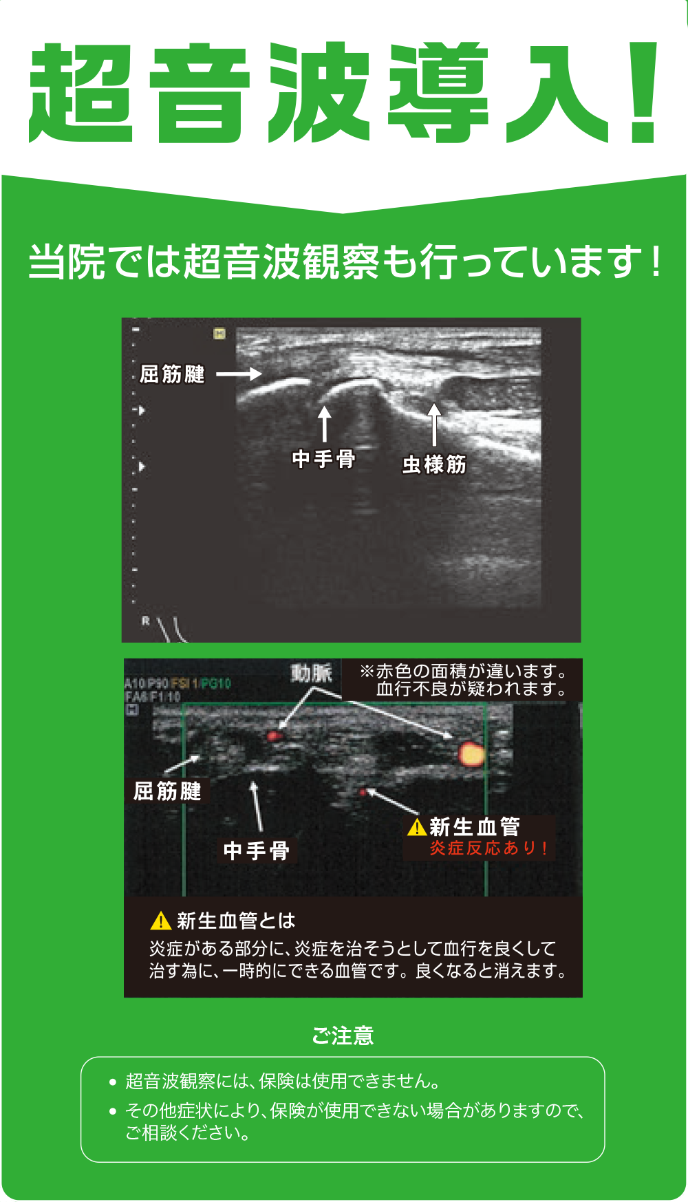 超音波導入!!当院では超音波観測も行なっています!ご注意・超音波観測には、保険は使用できません。・その他症状により、保険が使用できない場合がありますので、ご相談ください。