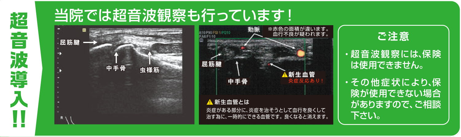 超音波導入!!当院では超音波観測も行なっています!ご注意・超音波観測には、保険は使用できません。・その他症状により、保険が使用できない場合がありますので、ご相談ください。